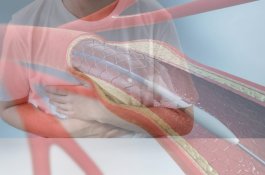 Pemerintah bakal Habiskan Rp 31 Triliun untuk Operasi Pasang Ring Jantung se-Indonesia