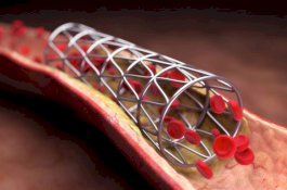Ini Penurun Kolestrol di Tengah Menu Lebaran, Alami dan Harganya Cuma Seribu