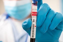 16.428 Kasus HIV Positif di Sulsel Hingga November 2022, LSL Sebanyak 30%&nbsp;