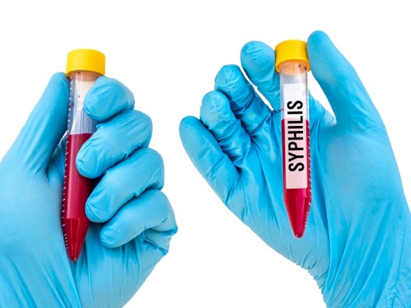 Tes Syphilis. (Ist).