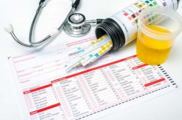 Buntut Temuan Narkoba, UNM Bakal Tes Urine Seluruh Civitas Akademika