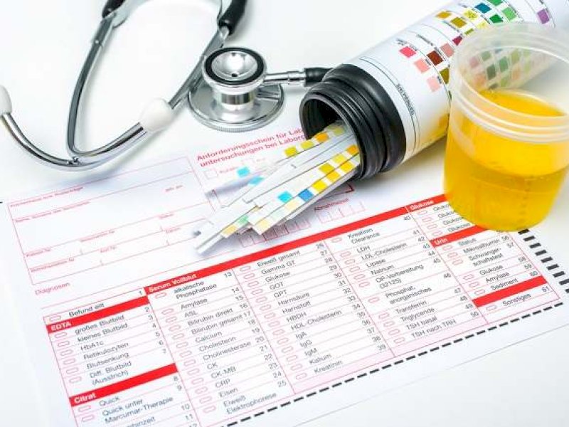 Ilustrasi tes urine. @Jejakfakta/dok. halodokter.com