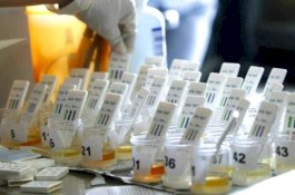 Mahasiswa Baru UNM 2023 Harus Bebas Narkoba, Jika Terindikasi Memakai Narkoba Langsung Direhabilitasi