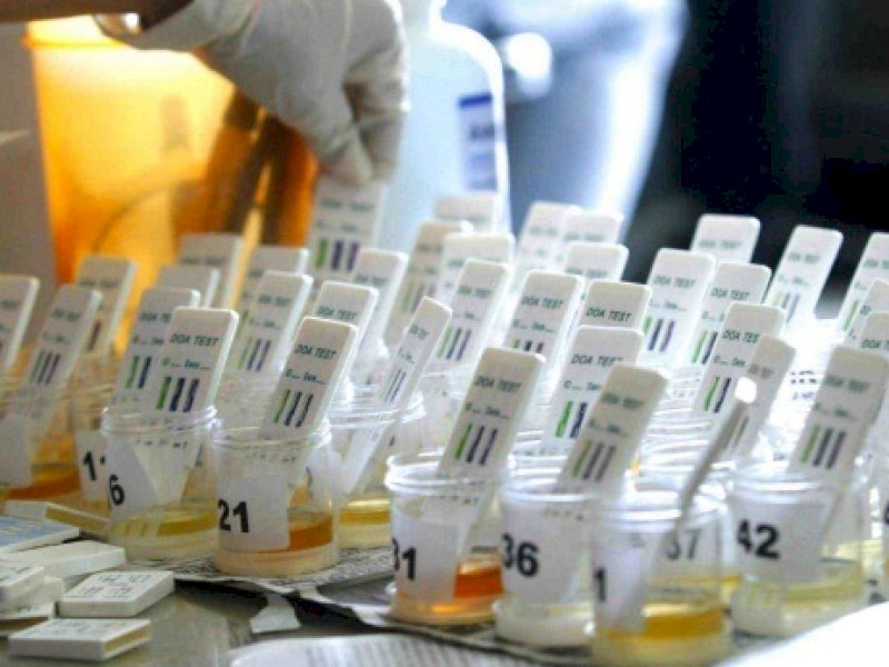 Ilustrasi tes urine bebas narkoba. @Jejakfakta/net