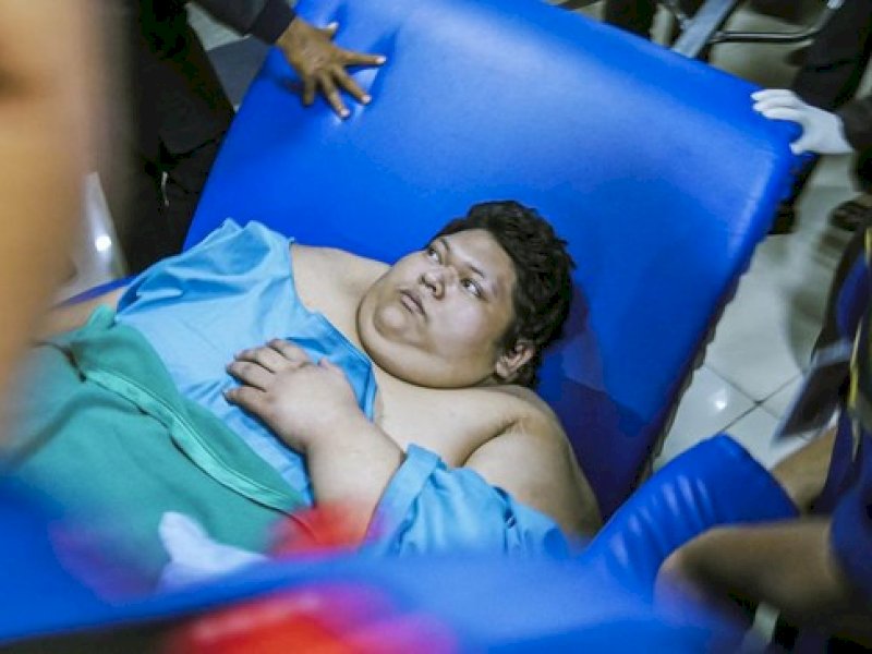 Fajri Pemuda Obesitas 300 Kg Meninggal Dunia Dini Hari di RSCM. Foto : Getty Imag/Future Publishing