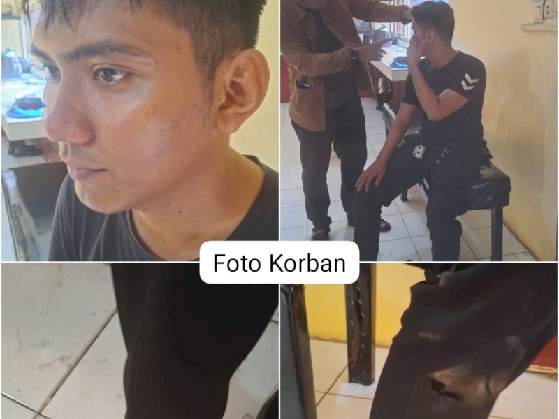 Penulis: Muslimin Emba | Editor: Hasriyani Latif
zoom-inlihat fotoBREAKING NEWS: Pengantar Jenazah Keroyok Polisi di Makassar, 4 Orang Ditangkap
ist
M Fathul anggota Polri yang menjadi korban penganiayaan pengantar jenazah di Jl Inspeksi Pam Lorong 3, Makassar, Senin (18/3/2024) malam. @Jejakfakta/dok. Humas Polrestabes Makassar