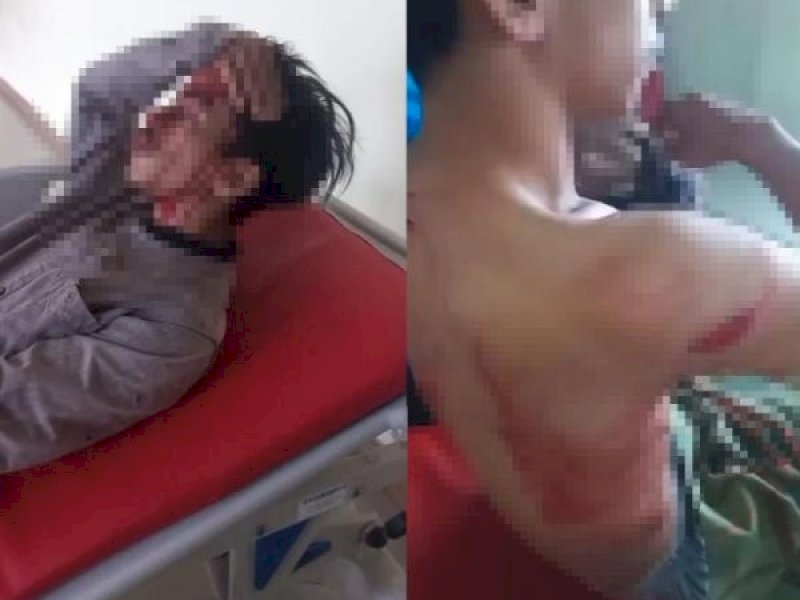 Salah Satui Korban Penolakan Tambang Pasir di Desa Karossa, Kecamatan Budong-Budong, Kabupaten Mamuju Tengah yang Menjadi Korban. @Jejakfakta/Foto: Ist