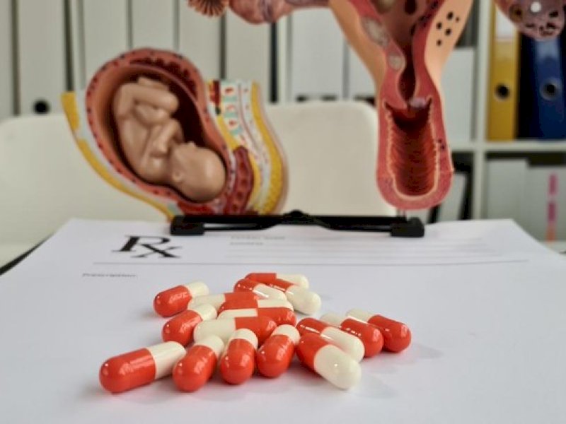 Ilustrasi aborsi. (Foto: Getty Images/iStockphoto)