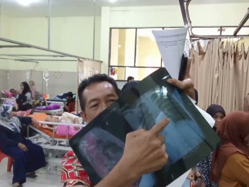 Petugas RS Syekh Yusuf Gowa memperlihatkan hasil rontgen korban Hardianto (35) yang diduga terdapat proyektil senapan angin di dalam tubuhnya. @Jejakfakta/Istimewa