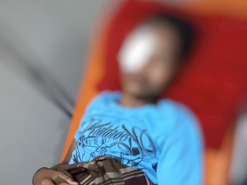 Ramadhan (15), warga Dusun Bontomanai, Desa Lempangan, Kabupaten Gowa mengalami luka pada bola mata kanannya akibat terkena tembakan peluru jeli, Kamis (5/3/2026). @Jejakfakta/dok. Istimewa